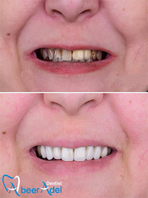 Dr. Abeer Adel | The best dentist in Egypt