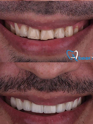 Dr. Abeer Adel | The best dentist in Egypt