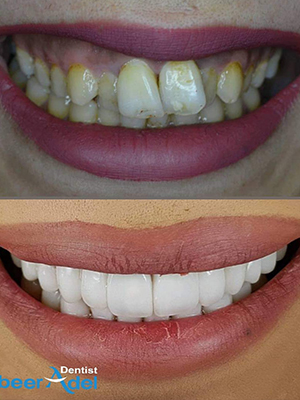 Dr. Abeer Adel | The best dentist in Egypt