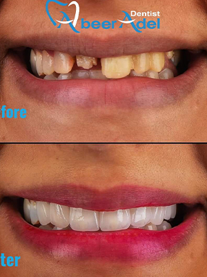 Dr. Abeer Adel | The best dentist in Egypt
