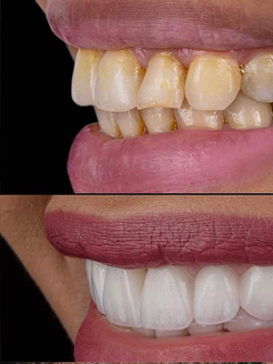 Dr. Abeer Adel | The best dentist in Egypt
