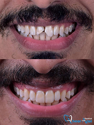 Dr. Abeer Adel | The best dentist in Egypt
