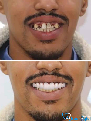 Dr. Abeer Adel | The best dentist in Egypt