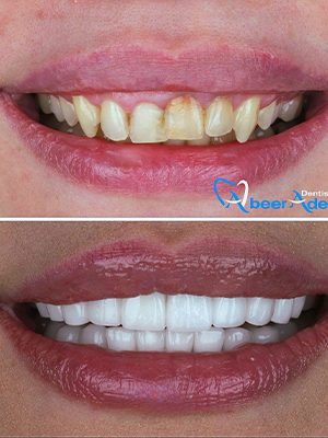Dr. Abeer Adel | The best dentist in Egypt