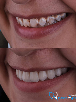 Dr. Abeer Adel | The best dentist in Egypt