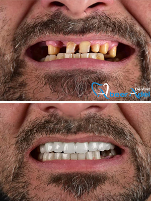 Dr. Abeer Adel | The best dentist in Egypt