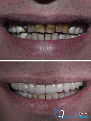 Dr. Abeer Adel | The best dentist in Egypt