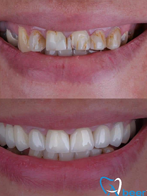 Dr. Abeer Adel | The best dentist in Egypt
