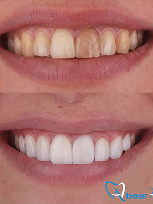 Dr. Abeer Adel | The best dentist in Egypt