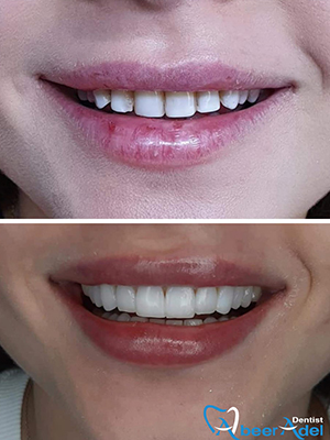 Dr. Abeer Adel | The best dentist in Egypt