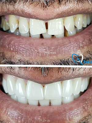 Dr. Abeer Adel | The best dentist in Egypt
