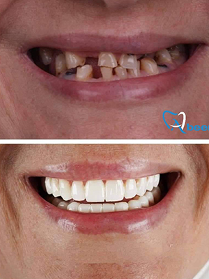 Dr. Abeer Adel | The best dentist in Egypt