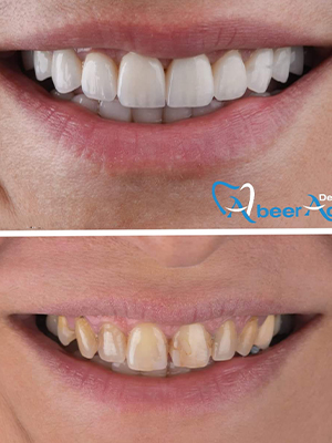 Dr. Abeer Adel | The best dentist in Egypt