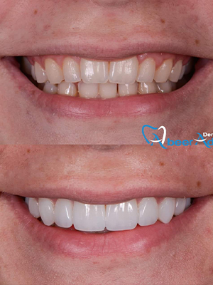 Dr. Abeer Adel | The best dentist in Egypt