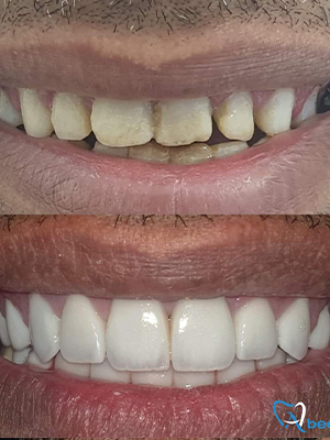 Dr. Abeer Adel | The best dentist in Egypt