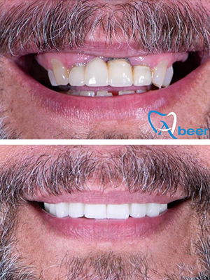 Dr. Abeer Adel | The best dentist in Egypt