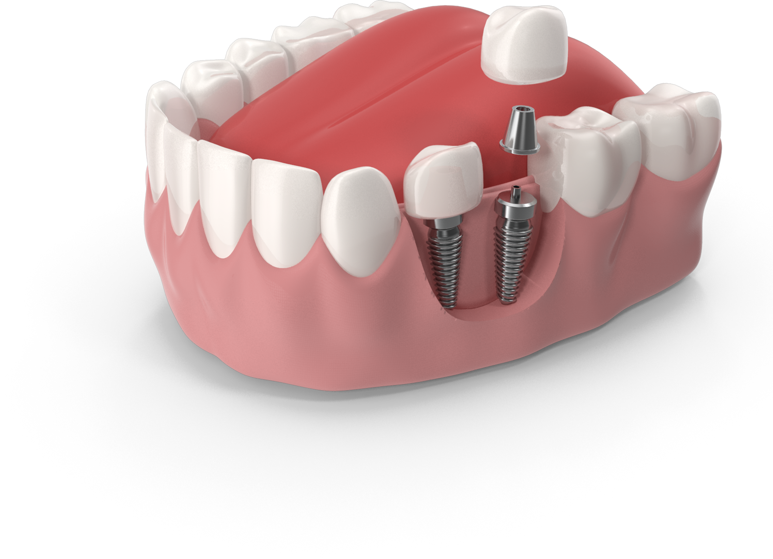 Dr. Abeer Adel | The best dentist in Egypt
