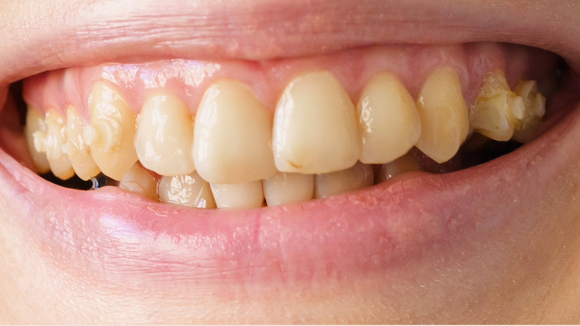 Dr. Abeer Adel | The best dentist in Egypt